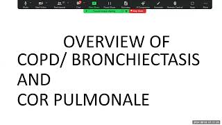 practice questions on bronchiectasis and lupus nephritis [upl. by Notreb]