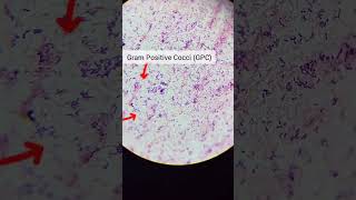 gram positive cocci GPC gram negative bacillignb [upl. by Laniger]