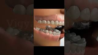 Jaw Treatment teeth dentist health [upl. by Assile817]