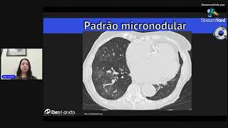 PADRÃO MICRONODULAR NA TC DE TÓRAX [upl. by Adeehsar520]