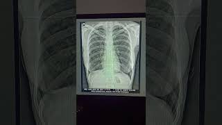 Xray multi medicalimaging [upl. by Enenaj49]