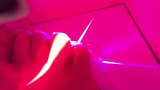 A foot in lunula laser at AampA Podiatrists [upl. by Jeuz]