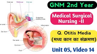 Otitis Media मध्य कान का संक्रमण GNM 2nd Year MSNII Video 14 Unit 05 सभी के लिए 202223 [upl. by Legnaesoj]