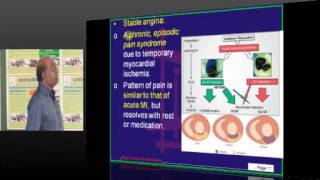 NEETPG Coaching Medicine Cardiology Topic 01 Coronary artry disease Part 03 [upl. by Tina428]