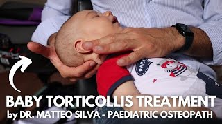 TORTICOLLIS TREATMENT by DR MATTEO SILVA  Paediatric Osteopath [upl. by Edmead557]