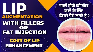 Lip Augmentation With Fillers Or Fat Injection  Cost Of Lip Enhancement In Delhi By Dr PK Talwar [upl. by Schindler215]