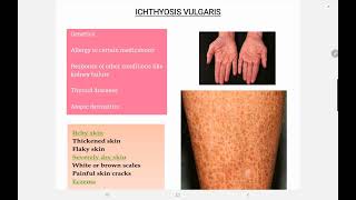 Ichthyosis Vulgaris [upl. by Nert287]