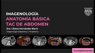 TAC DE ABDOMEN  ANATOMÍA RADIOLÓGICA BÁSICA [upl. by Snej63]