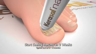 Kerasal Nail Restore Healthy Nail Appearance 15 Sec [upl. by Oker]