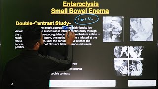 Small Bowel Enema  Enteroclysis Procedure  Part2  In Hindi  Radiological Procedure [upl. by Adriel]