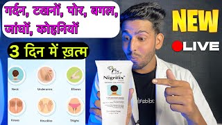 Nigrifix cream full review  nigrifix cream review  fixderma nigrifix cream  nigrifix cream use [upl. by Basilius]