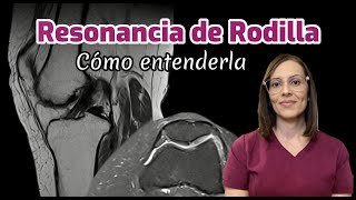 Resonancia de Rodilla [upl. by Sixla]