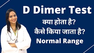 D Dimer Test Kya Hota Hai Kis Liye Kiya Jata Hai Normal Range Report Reading [upl. by Farmann394]