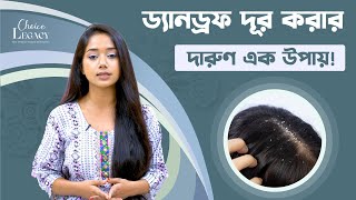 Salicylic acid for dandruff treatment ড্যানড্রফ দূর করতে স্যালিসাইলিক এসিড [upl. by Ativ]