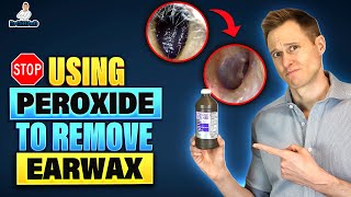 Stop Using Hydrogen Peroxide to remove Earwax [upl. by Ettenom]