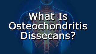 What Is Osteochondritis Dissecans [upl. by Akienom]