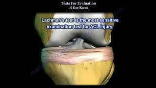 Tests For Examination Of The Knee Everything You Need To Know Dr Nabil Ebraheim [upl. by Sehcaep397]