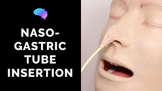 Nasogastric NG Tube Insertion  OSCE Guide  UKMLA  CPSA [upl. by Akeyla]