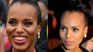 Sad News For Kerry Washington As She Has Been Confirmed To Be [upl. by Bonnibelle]