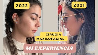 Mi experiencia Recuperación post cirugía Maxilofacialortognatica Durante 1 mes parte 2 [upl. by Cichocki]