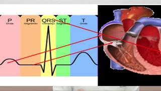 Ritmos cardíacos de paro cardíaco [upl. by Llenad]