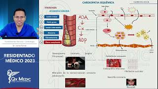 Cardiología Cardiopatía Isquémica  RM 2023 [upl. by Rdnaskela]