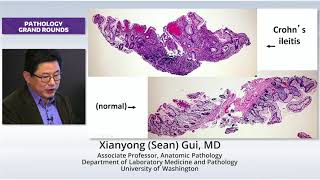 New Concepts in IBD Pathology [upl. by Durgy490]