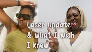 6 Month Laser Hair Removal Update amp 5 Things I wish I knew before Starting Laser [upl. by Gnuh]