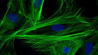 Microscopía de Fluorescencia y detección de virus por inmunofluorescencia [upl. by Letniuq]