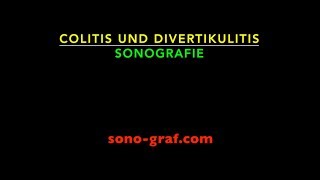 077  Sonografie  Colitis und Divertikulitis [upl. by Etnaled]