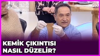 Ayakta Kemik Çıkıntısının Tedavisi Nasıl Yapılır  Feridun Kunak Show  13 Şubat 2019 [upl. by Ainaznat]