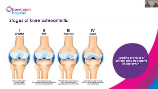 Benenden Hospital webinar Treatment for knee osteoarthritis [upl. by Lledraw846]