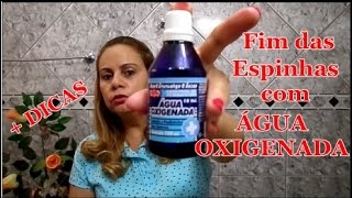 Como acabar com as Espinhas de vez com ÁGUA OXIGENADA  DICAS [upl. by Otilesoj]