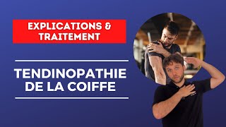 Nouvelles approches de rééducation pour une TENDINOPATHIE de la COIFFE  Explications amp traitement [upl. by Zamora]