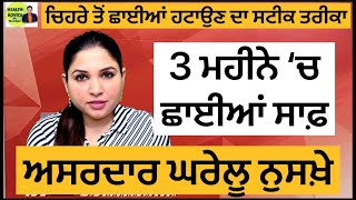 ਚਿਹਰੇ ਤੋਂ ਛਾਈਆਂ ਹਟਾਉਣ ਦਾ ਘਰੇਲੂ ਨੁਸਖ਼ਾ  Treat Pigmentation Melasma At Home  Health Advice [upl. by Ayres]