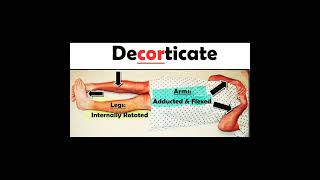 decorticate vs decerebrate posturing [upl. by Lenore]