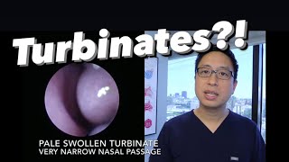 Inferior Turbinates what are they why do they swell stuffy nose congestion how do we treat [upl. by Rollins135]