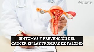 CÁNCER DE TROMPAS DE FALOPIO  Síntomas y prevención [upl. by Eecart]