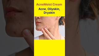 AcneMoist Cream Use in Hindi AcneaOilySkinskmedicine dryskin [upl. by Neill339]