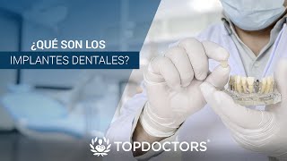 IMPLANTES DENTALES 🦷 5 Cosas que DEBES Saber 👨‍⚕ [upl. by Greiner350]