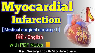 Myocardial infarction  Myocardial infarction in hindi  Myocardial infarction msn  bsc nursing 2nd [upl. by Slaohcin]