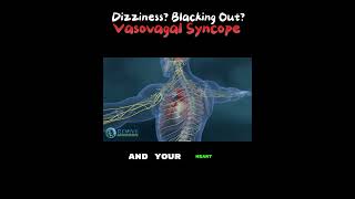 What is Vasovagal Syncope blackingout fainting [upl. by Wehttam]