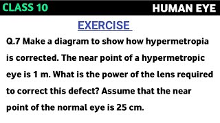 Make a diagram to show how hypermetropia is corrected The near point of a hypermetropic eye is 1 m [upl. by Lechner]