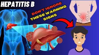 Identify Warning Signs of Hepatitis B  Signs and Symptoms of Hepatitis B [upl. by Bhatt]