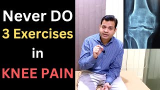 Never Do 3 Exercises in Knee Pain Knee osteoarthritis Patellofemoral Syndrome Knee Pain Treatment [upl. by Lorry784]