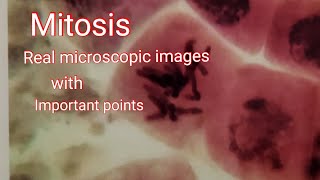 Mitosis  Real microscope image cell division with important points [upl. by Esele941]