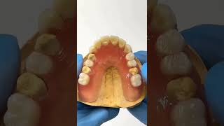 Upper fiberFlex partial [upl. by Latsirc]