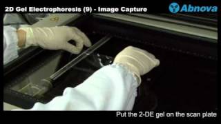 2D Gel Electrophoresis 9 Image Capture  Laser Scanner [upl. by Reidid946]