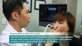 Ultrasound Intra Oral Scanning Procedure [upl. by Fanny]