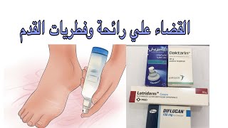 التخلص من رائحة القدم الكريهة والفطريات [upl. by Anaidiriv]